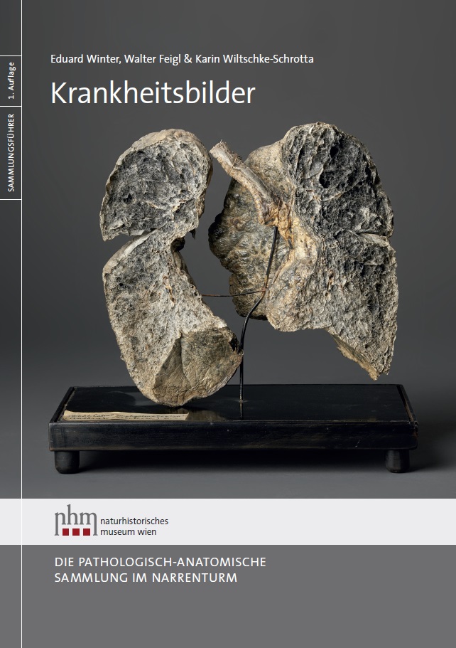 Winter, Eduard – Walter Feigl – Karin Wiltschke-Schrotta : Krankheitsbilder. Die pathologisch-anatomische Sammlung im Narrenturm Winter, Eduard – Walter Feigl – Karin Wiltschke-Schrotta : Krankheitsbilder. Die pathologisch-anatomische Sammlung im Narrenturm